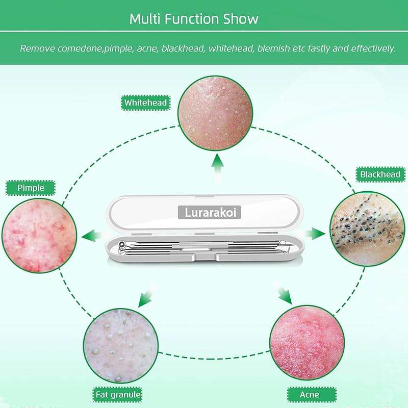5PCS Blackhead Remover Comedone Extractor, Curved Blackhead Tweezers Kit, Professional Stainless Pimple Acne Blemish Removal Tools Kit for Manual - Image 6