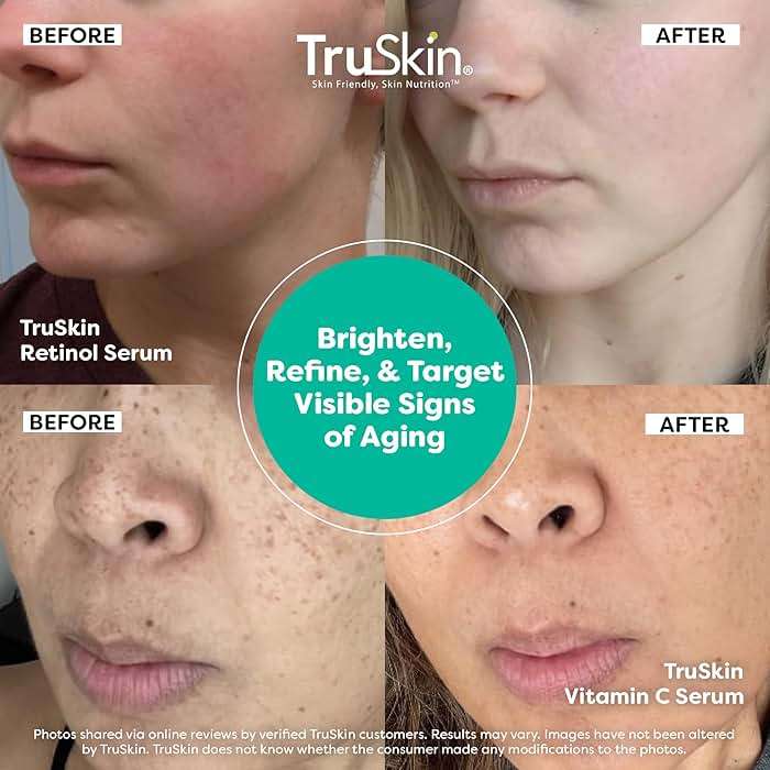 TruSkin Face Serum Duo - Vitamin C Serum & Retinol Serum for Face - AM & PM Anti Aging Skincare Routine - Brightening & Smoothing Facial Serums, 1 fl oz Each - Image 4