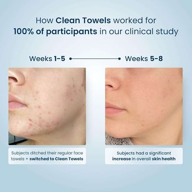 Clean Skin Club Clean Towels®, 100% USDA Biobased Face Towel, Disposable Face Towelette, Eczema Association Accepted, Makeup Remover Dry Wipes, Ultra Soft, 1 Pack, 25 Ct - Image 8