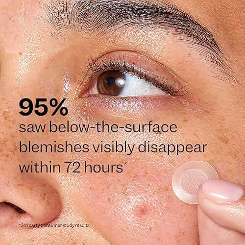Peach Slices - Deep Blemish Microdarts (9 ct) - Early Stage Pimple Patches for Face - Salicylic Acid, Niacinamide, Hyaluronic Acid, Tea Tree Oil & Cica - Vegan, Cruelty Free, Korean Skin Care & Beauty | Salicylic Acid - Image 6