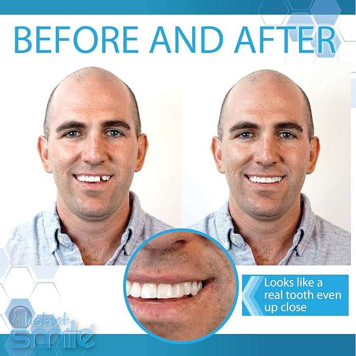 Complete Your Smile Tooth Replacement Kit DELUXE PACK - Includes Patented Complete Your Smile Tooth Replacement Kit and Jar of Instant Smile Replacement Beads - Image 3