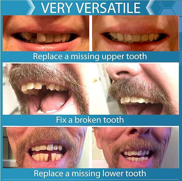 Complete Your Smile Tooth Replacement Kit DELUXE PACK - Includes Patented Complete Your Smile Tooth Replacement Kit and Jar of Instant Smile Replacement Beads - Image 4