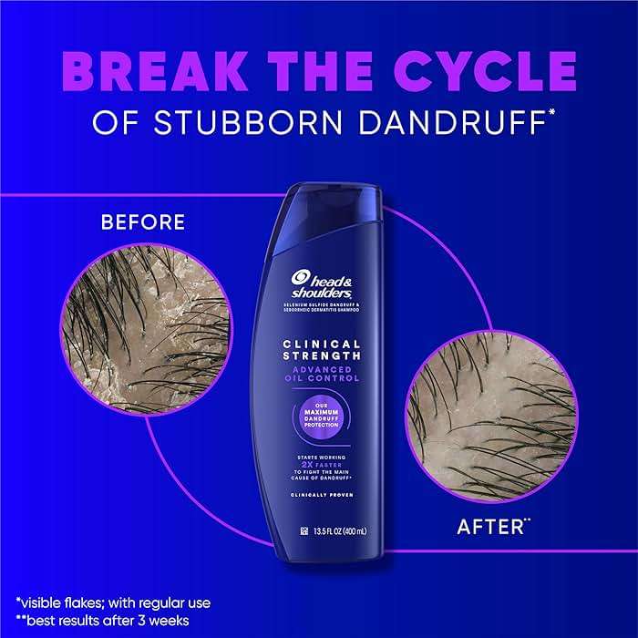 Head & Shoulders Anti-Dandruff Shampoo with 1% Selenium Sulfide, Clinical Strength Advanced Oil Control Twin Pack, Seborrheic Dermatitis Relief, Oily Scalp, 13.5 Fl Oz Each - Image 4