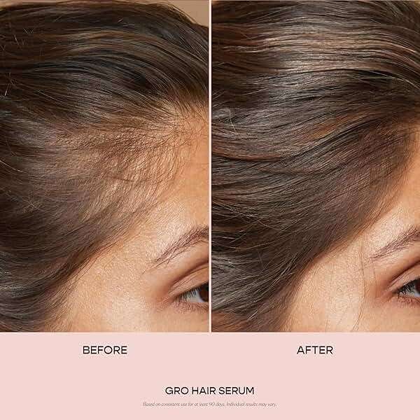 VEGAMOUR GRO Hair Serum for Hair Thinning & Shedding, Thicker Fuller Looking Hair In As Soon As 90 Days, Non Oily, Bergamot Scent, Vegan & Cruelty Free - Image 2