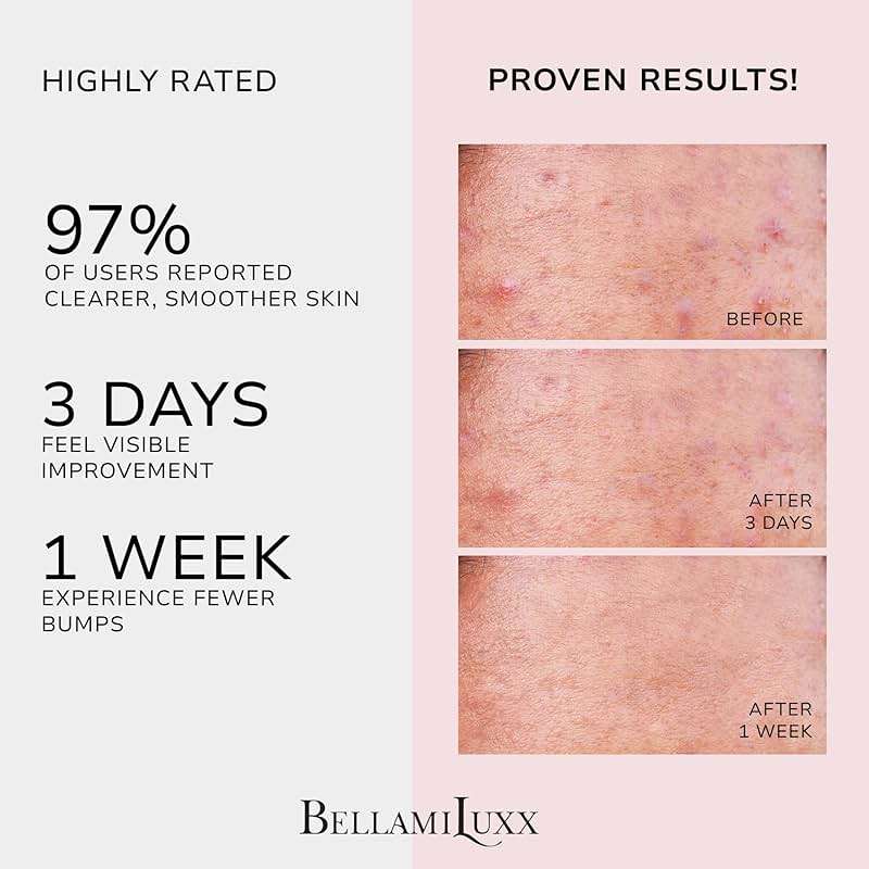 BellamiLuxx Butt Acne Clearing Treatment Cream: Body Acne Treatment for Folliculitis and Pimples on Buttocks, Thighs, and Body with 2% Salicylic Acid & Tea Tree Oil - Butt Cream for Smooth Skin - Image 2