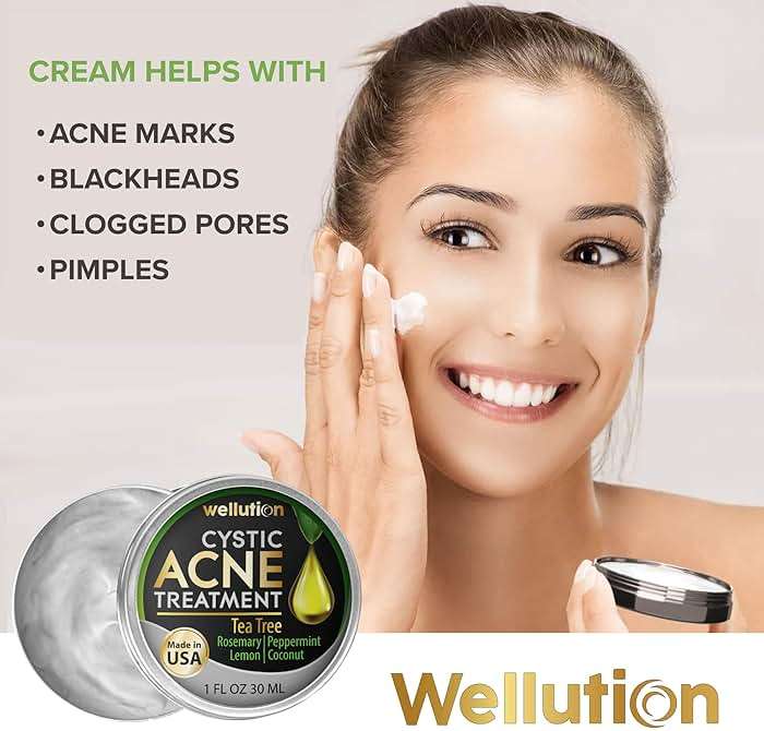 Cystic Acne Spot Treatment – Tea Tree Acne Cream – Fast-Acting Acne Spot Corrector for Face, Pimples & Blemishes – Non-Greasy, Gentle Formula – 1oz – by WELLUTION - Image 2