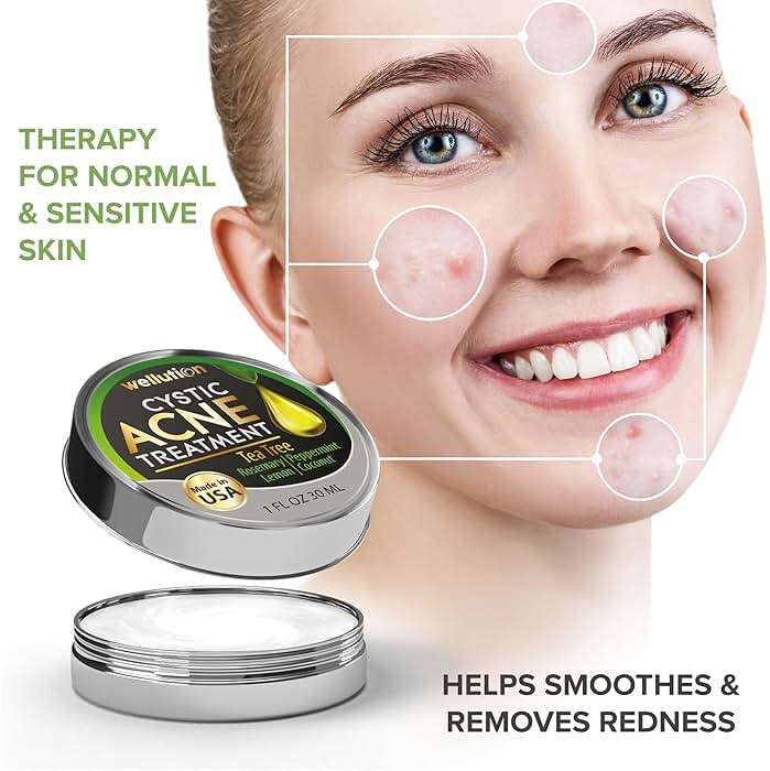 Cystic Acne Spot Treatment – Tea Tree Acne Cream – Fast-Acting Acne Spot Corrector for Face, Pimples & Blemishes – Non-Greasy, Gentle Formula – 1oz – by WELLUTION - Image 3