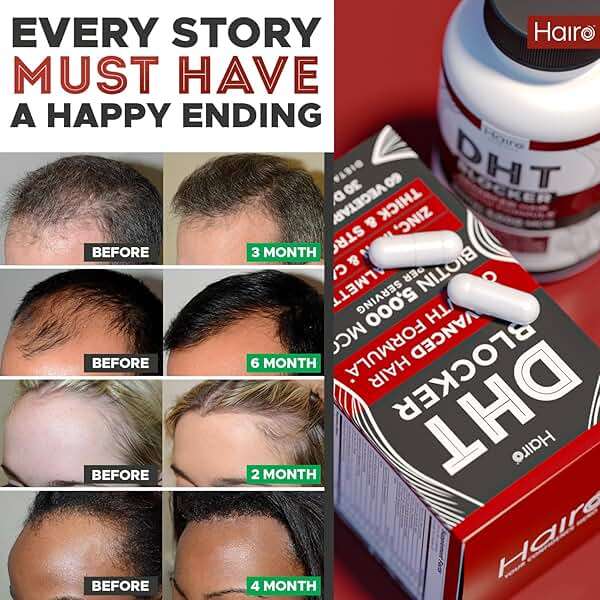 DHT Blocker Hair Growth Supplement - High Potency Biotin & Saw Palmetto for Hair Regrowth - Natural Hair Loss Treatments for Women & Men - Helps Stimulate Hair Follicle Growth - Image 5