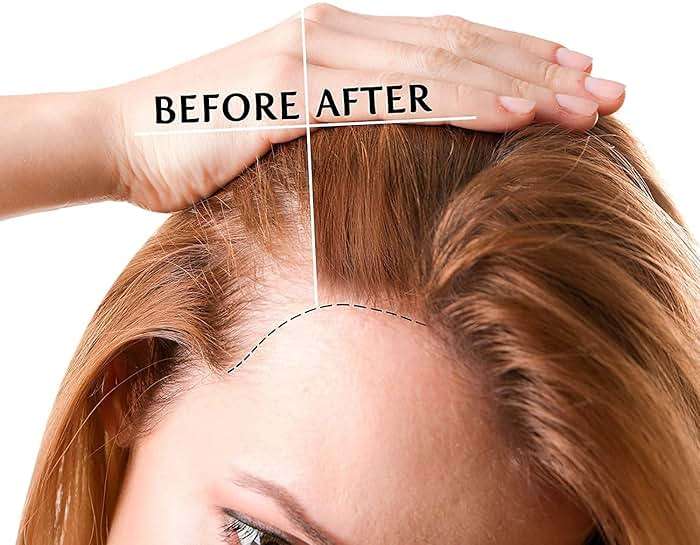 Luv Me Care Biotin Hair Growth Oil Hair Growth Serum for Thicker Longer Fuller Healthier Hair, Prevent Hair Loss & Thinning, All Natural Vitamin Rich Treatment, Women & Men, All Hair Types 1.7 oz - Image 2