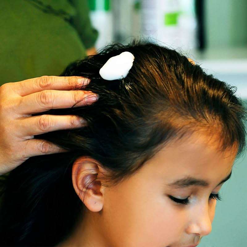 My Hair Helpers Natural Enzymes for Head Lice - Mousse Naturally Dissolves Nit Glue - Unscented Lice Removal Works on 1-2 Children, 4 fl Ounces - Image 6