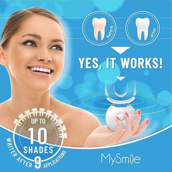 MySmile Teeth Whitening Kit with LED Light, 10 Min Non-Sensitive Whitener - Image 2