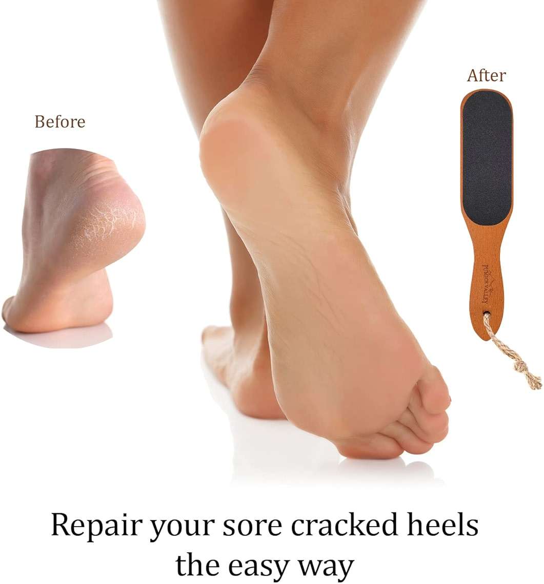 Pumice Stone Foot File - Wooden Pedicure Feet Scrubber with Handle for Callus, Dry, and Dead Skin Removal - Heel Scraper for Feet, Hands, and Body - Foot Filer for Use in Shower - Image 5