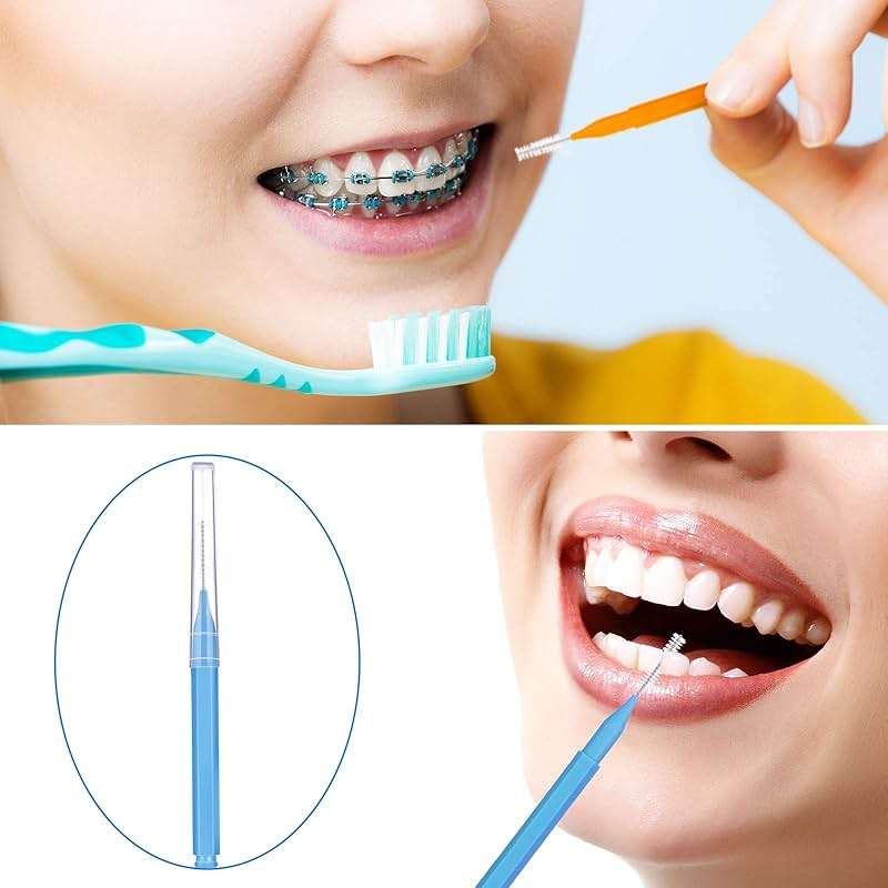Patelai 100 Pieces Braces Dental Brush for Cleaner Interdental Toothpick Dental Tooth Flossing Head Oral Hygiene Flosser Toothpick Cleaners Tooth Tool(Bright Colors,Multiple Sizes) - Image 5