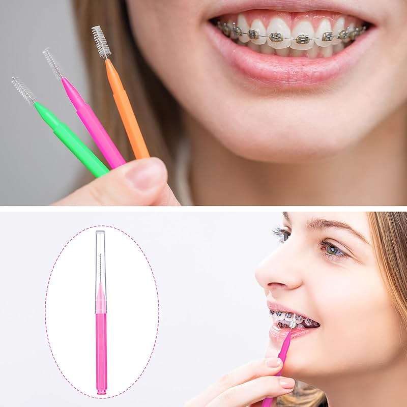 Patelai 100 Pieces Braces Dental Brush for Cleaner Interdental Toothpick Dental Tooth Flossing Head Oral Hygiene Flosser Toothpick Cleaners Tooth Tool(Bright Colors,Multiple Sizes) - Image 6