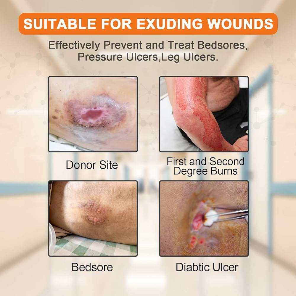 Carbou Silicone Sacrum Foam Dressing, 9''x9''(23cm x23cm) Bordered Adhesive Sacral Foam Dressing,Soft Bed Sore Bandages,Wound Care Products,Box of 5 Dressings - Image 3