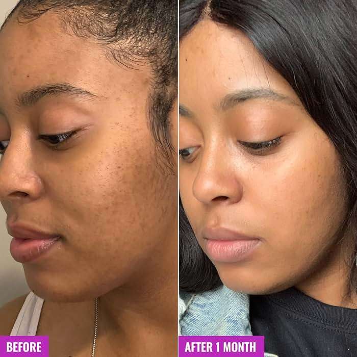 Good Molecules Glycolic Exfoliating Toner - Hyaluronic and Glycolic Acid Daily Toner for Face - Cleansing Facial Exfoliant for Glowing Even Skin Tone, Skin Care - Image 5
