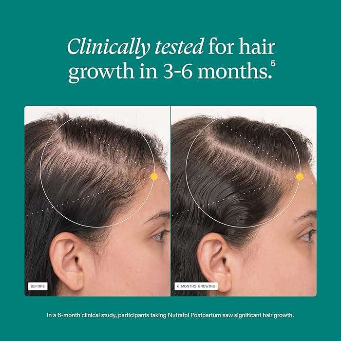 Nutrafol Postpartum Hair Growth Supplement - Image 4