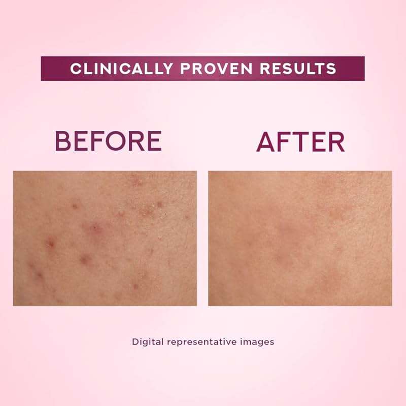 POND'S Bright Beauty SPF 15 PA ++ Serum Cream 50 g - Image 4