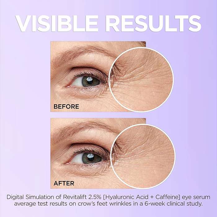 L'Oreal Paris Revitalift Hyaluronic Acid + Caffeine Hydrating Eye Serum for Dark Circles, Fragrance Free .67 fl. oz + Moisturizer Sample - Image 6