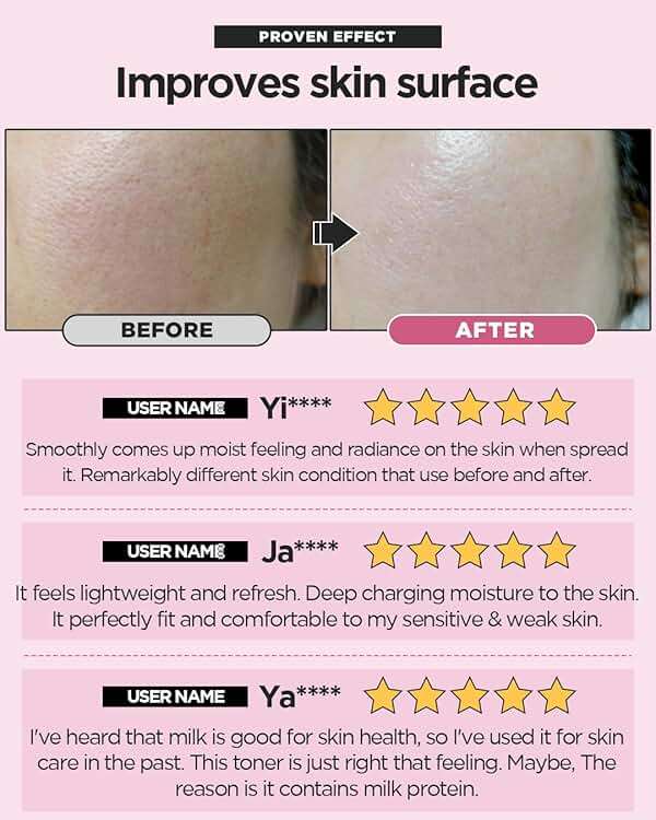SKINRxLAB MadeCera Cream Double Essence Korean Toner 150ml (5.07fl.oz.) - Hydrating and Soothing with Milk Protein, Ceramide, Beta-Glucan - Moisturizing Strawberry Milky Toner for Irritated Skin - Image 3