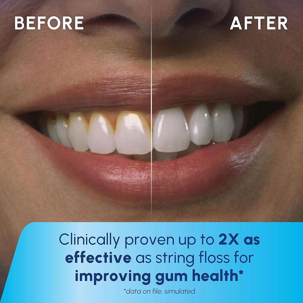 Waterpik Cordless Pearl Rechargeable Portable Water Flosser for Teeth, Gums, Braces Care and Travel, Extra Quiet, 4 Flossing Tips - ADA Accepted, WF-13 White, Amazon Exclusive - Image 5