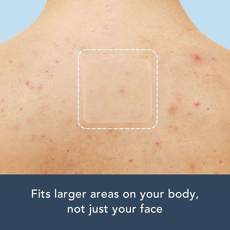 Rael Pimple Patches, Miracle XL Spot Control Cover - Hydrocolloid Acne Pimple Patch for Face, Zits & Blemish, Back and Body, Korean Skin Care (8 Count) - Image 6