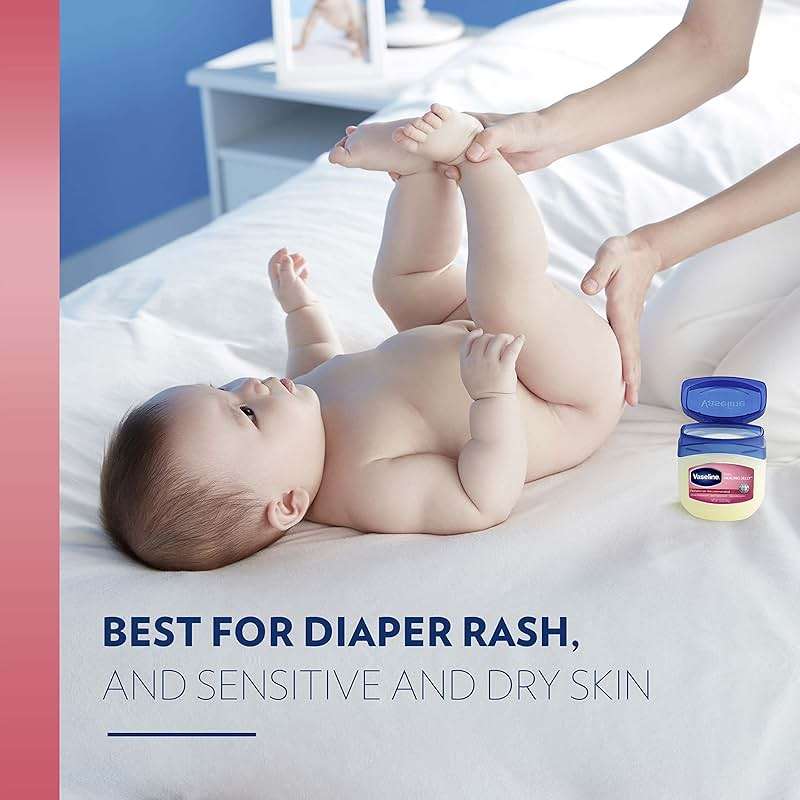 Vaseline Healing Jelly Baby, 2-Pack – Hypoallergenic Moisturizer for Baby Care, Diaper Rash, Sensitive and Dry Skin, Baby Powder Scent, 13 Oz Ea - Image 3