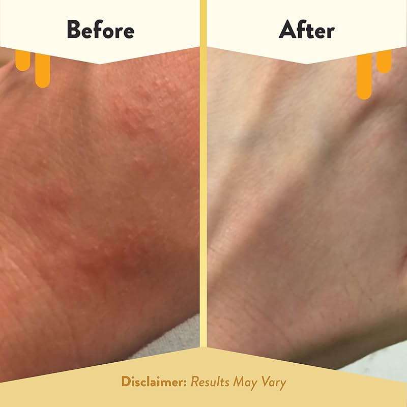 ECZEMA HONEY Oatmeal Body Lotion - Hand & Body Cream for Eczema Relief - Natural Dry Skin Repair (16 Oz) - Image 4