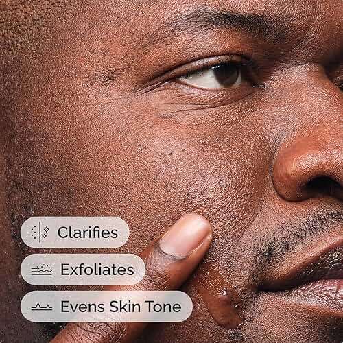 The Ordinary Salicylic Acid 2% Anhydrous Solution, Gentle Exfoliating Serum for Blemish-Prone Skin and Uneven Texture - Image 4