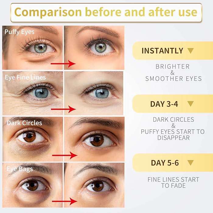 NAZANO 24K Gold Under Eye Patches - 60 Pack for Puffy Eyes, Dark Circles, Bags & Wrinkles with Collagen & Hyaluronic Acid - Eye Care Pads for Daily Skincare (Gold) - Image 3