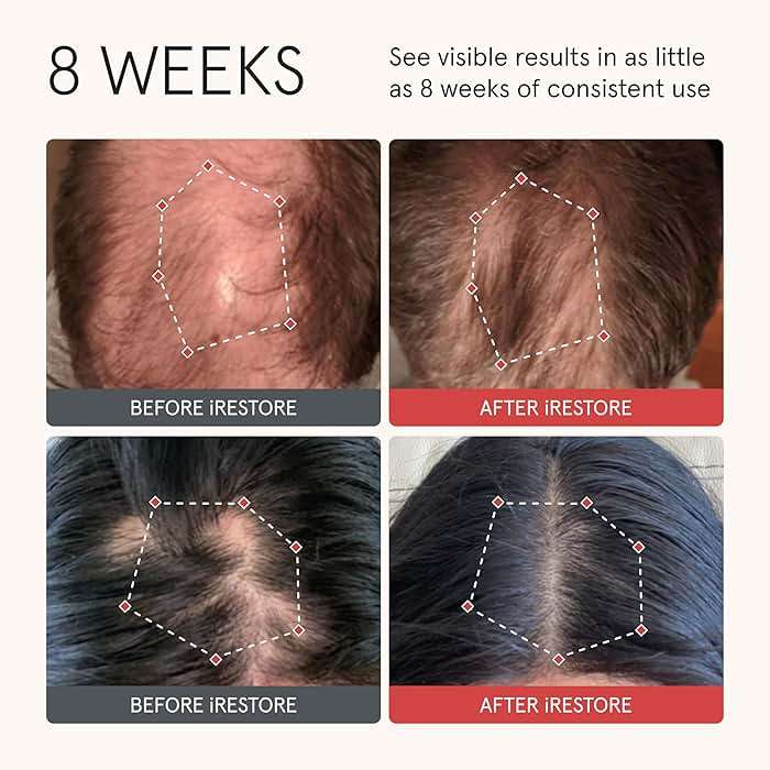 iRESTORE Biotin Hair Conditioner for Damaged Dry Hair - Good for Fine Hair Growth, Volumizing Thickening Conditioner with Ginseng & Argan Oil to Moisturize, Pair With Hair Loss Shampoo - Image 2