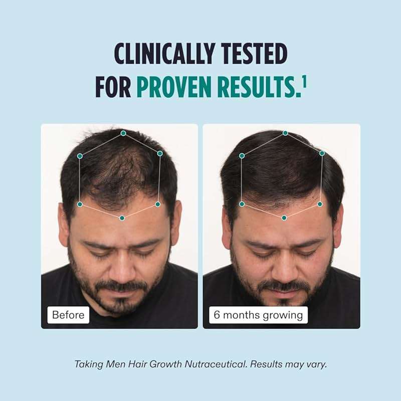 Nutrafol Men's Hair Growth Supplement and Collagen Peptides Powder, Physician-formulated for Visibly Thicker, Stronger Hair, Dermatologist Recommended - 1 Month Supply, 12 oz Bottle - Image 4