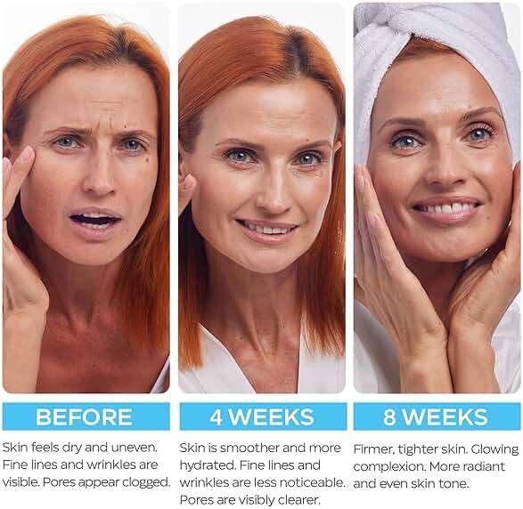 Retinol Cream for Face with Hyaluronic Acid, Day-Night Anti-Aging Moisturizer for Women, Men, Collagen Cream for Face Reduces Wrinkles, Dryness, 1.85 Oz - Image 7