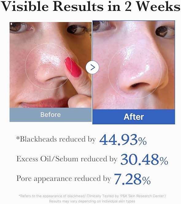 Medicube Zero Pore Pads 2.0, Dual-Textured Facial Toner Pads for Exfoliation and Pore Care with 4.5% AHA Lactic Acid & 0.45% BHA Salicylic Acid, Ideal for All Skin Types, Korean Skin Care (70 units) - Image 5