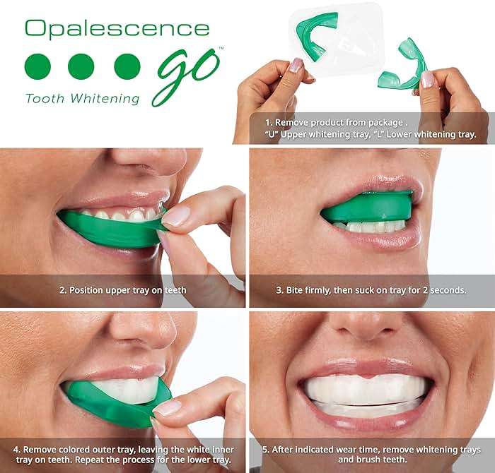 Opalescence Go 10% Whitening Bundle Prefilled Gel Whitening Trays - (10 Treatments) Hydrogen Peroxide 10% - Includes Opalescence Whitening Toothpaste. Teeth Whitening Kit -Mint- 5194-5166 - Image 3
