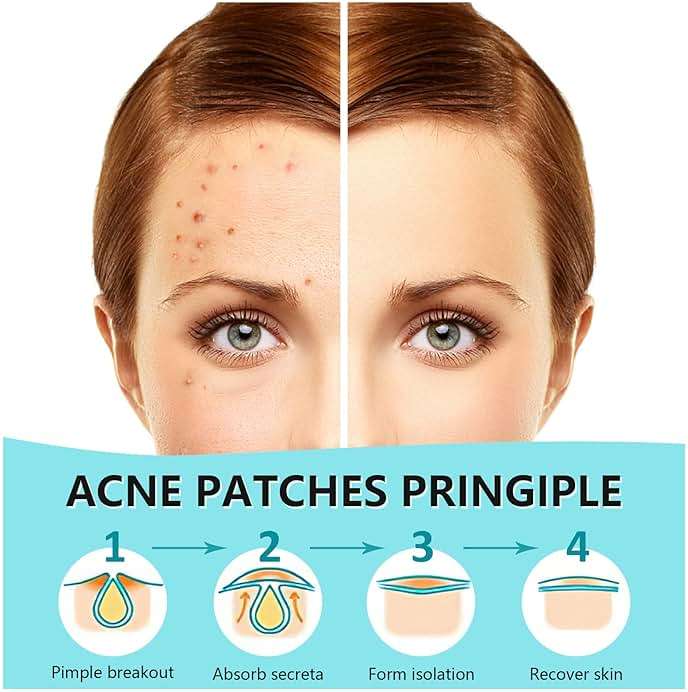 PICcircuit 180 Counts Pimple Patches for Face Hydrocolloid Acne Patches for face Invisible Zit Patches for Face Pimple Patch Acne Spot Treatment Patch Blemish Patches Cover Patches Stickers - Image 2