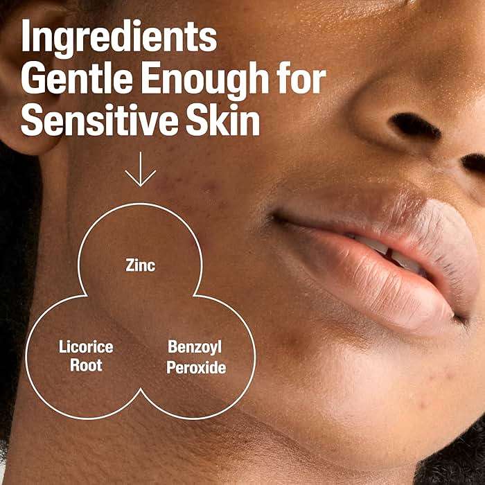Cetaphil Gentle Clear Complexion-Clearing BPO Acne Cleanser with 2.6% Benzoyl Peroxide, Creamy and Soothing for Sensitive Skin, Suitable for All Skin Types, 4.2oz - Image 5