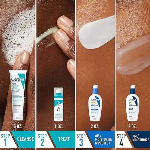CeraVe Acne Skin Care Set, 5oz Acne Foaming Cream Cleanser + 1oz Resurfacing Retinol Serum + 2oz AM Facial Moisturizing Lotion with SPF 30 + 2oz PM Facial Moisturizing Lotion - Image 2