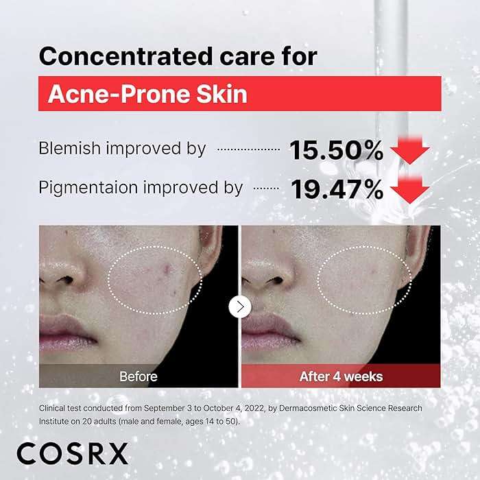COSRX 15% Niacinamide Face Serum, 0.67 fl oz, Pore Minimizer Serum for Face, Even Skin Tone, Korean Skin Care - Image 4