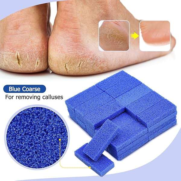 Disposable Foot Scrubber Sponge Pads Pedicure Pumice Stone for Feet Callus Remover Coarse Blue 40Pcs - Image 5