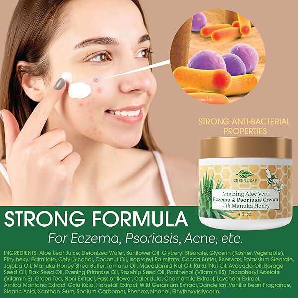 Manuka Honey Eczema Cream Moisturizing Lotion Treatment for Psoriasis Relief - Itchy, Dry Skin Rash Ointment - Soothing Moisturizer for Baby, Kids, Adults - High Strength Body & Face Cream 2oz - Image 2