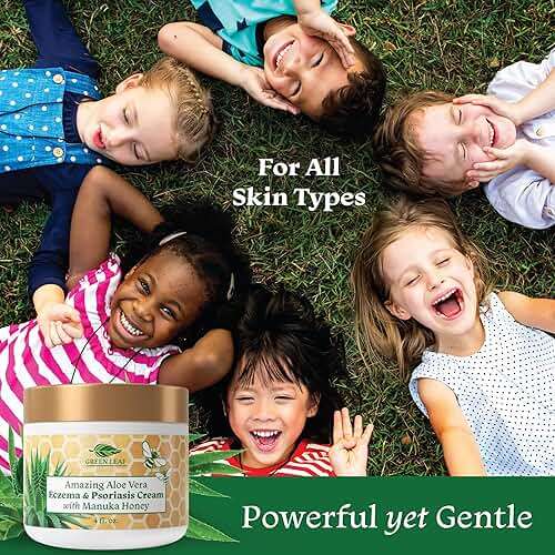 Manuka Honey Eczema Cream Moisturizing Lotion Treatment for Psoriasis Relief - Itchy, Dry Skin Rash Ointment - Soothing Moisturizer for Baby, Kids, Adults - High Strength Body & Face Cream 2oz - Image 5