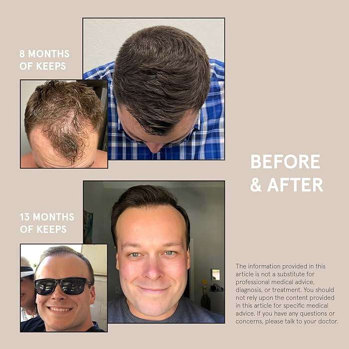 Keeps Thickening Shampoo & Conditioner for Men - Anti-Thinning Hair Care Duo with Biotin, Caffeine & Saw Palmetto - Color-Safe Men's Volumizing Shampoo & Conditioner - DHT-Blocker - 8 Oz Each - Image 7