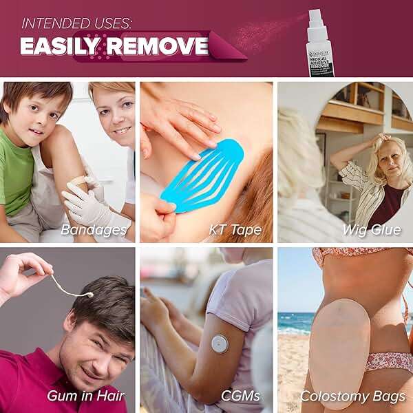 Skinister Medical Adhesive Remover for Skin | Wig, Ostomy, Tape, and Bandage Adhesive Remover | Silicone-Based, Hypoallergenic, Sting-Free | 2oz Spray - Image 2