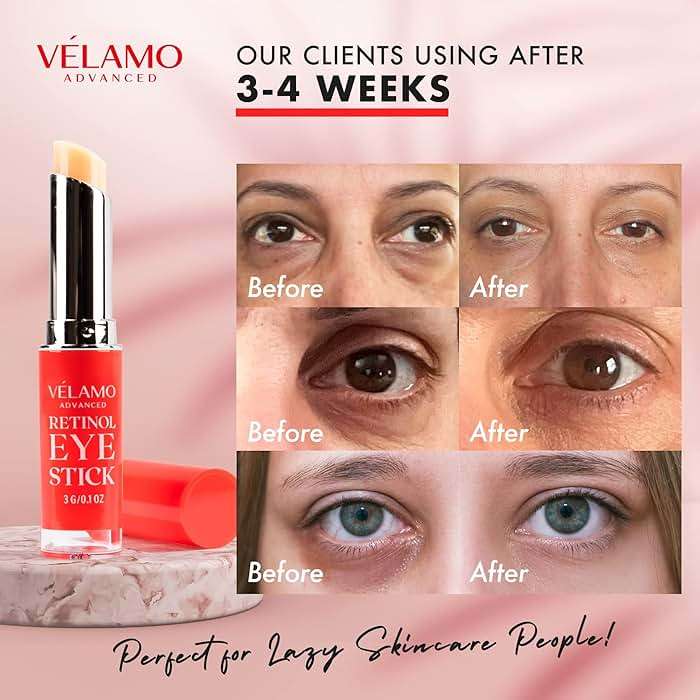 VELAMO ADVANCED Retinol Eye Stick: Renewing & Firming Under Eye Balm for Dark Circles, Puffiness, Fine Lines & Wrinkles - Travel Essentials, Portable & Perfect for On-the-go Use, 0.1 OZ/3g - Image 5
