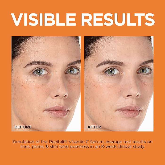 L'Oreal Paris Revitalift 12% Pure Vitamin C Serum, Brightening Serum For Face with Vitamin E, Salicylic Acid, 1 oz + Moisturizer Sample - Image 5