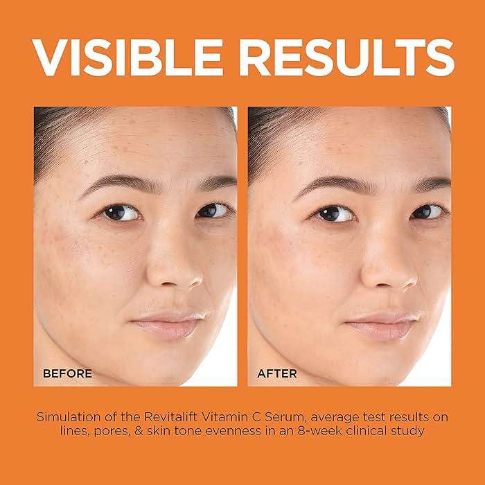 L'Oreal Paris Revitalift 12% Pure Vitamin C Serum, Brightening Serum For Face with Vitamin E, Salicylic Acid, 1 oz + Moisturizer Sample - Image 6