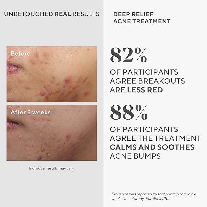 Murad Deep Relief Acne Spot Treatment with 2% Salicylic Acid – Patch-Like Liquid Treatment for Deep, Hormonal Acne & Breakouts – 1 Fl Oz - Image 4