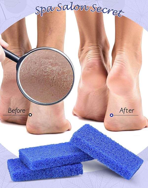 Maryton Disposable Foot Scrubber Pumice Pads, Pedicure Pumice Stone Dead Skin Callus Remover for Feet, 40Pcs (Dark Blue Coarse) - Image 4