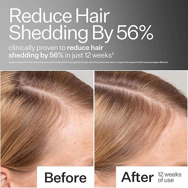 Act+ Acre Cold Processed Stem Cell Scalp Serum | For Thicker, Fuller Looking Hair | Apple Stem Cells, Bamboo Extract, Aloe Vera | Strengthen, Hydrate, Reduce Shedding | Vegan, Color Safe | 2.2 Fl Oz - Image 2